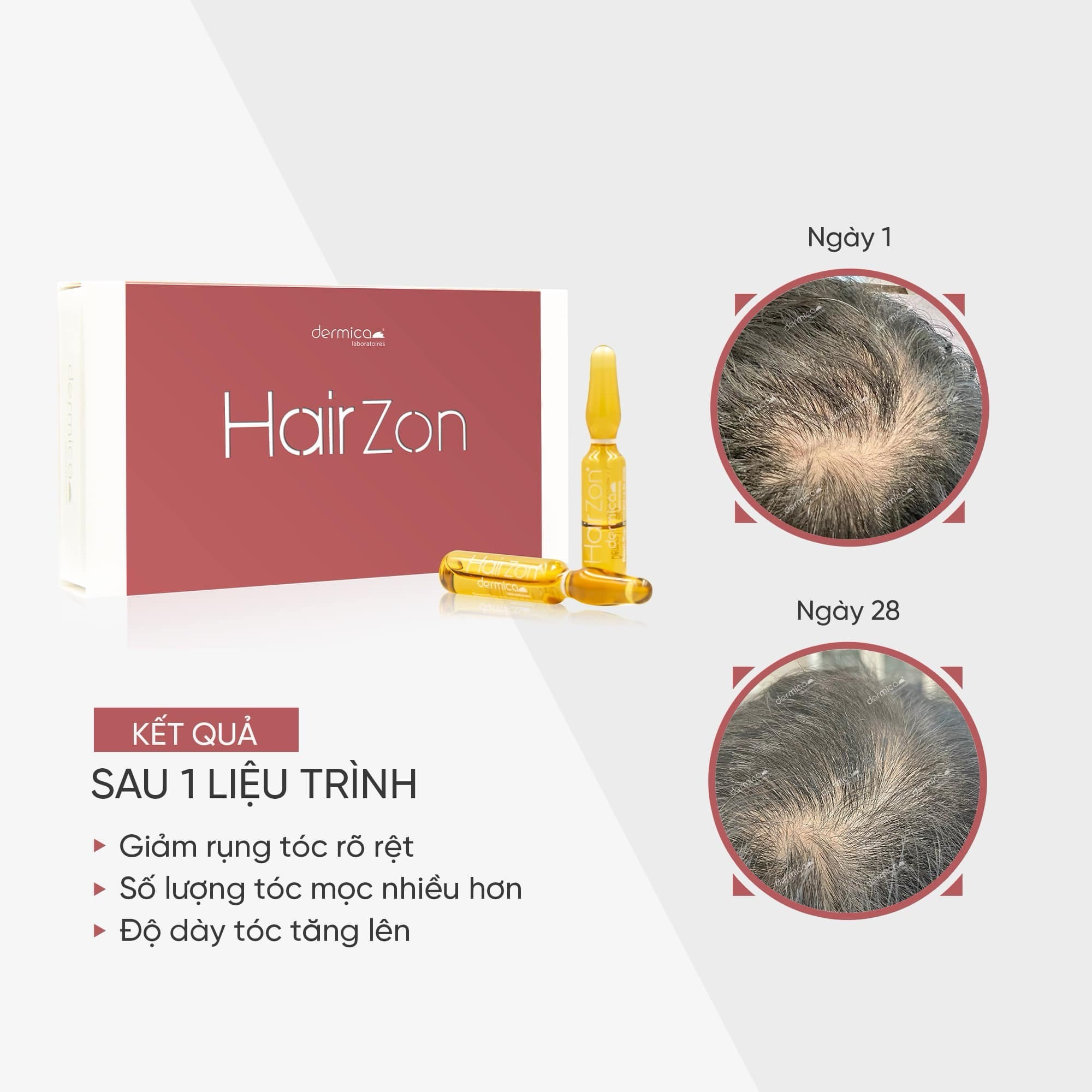 /storage/product/7/Dermica-HairZon-2.jpg