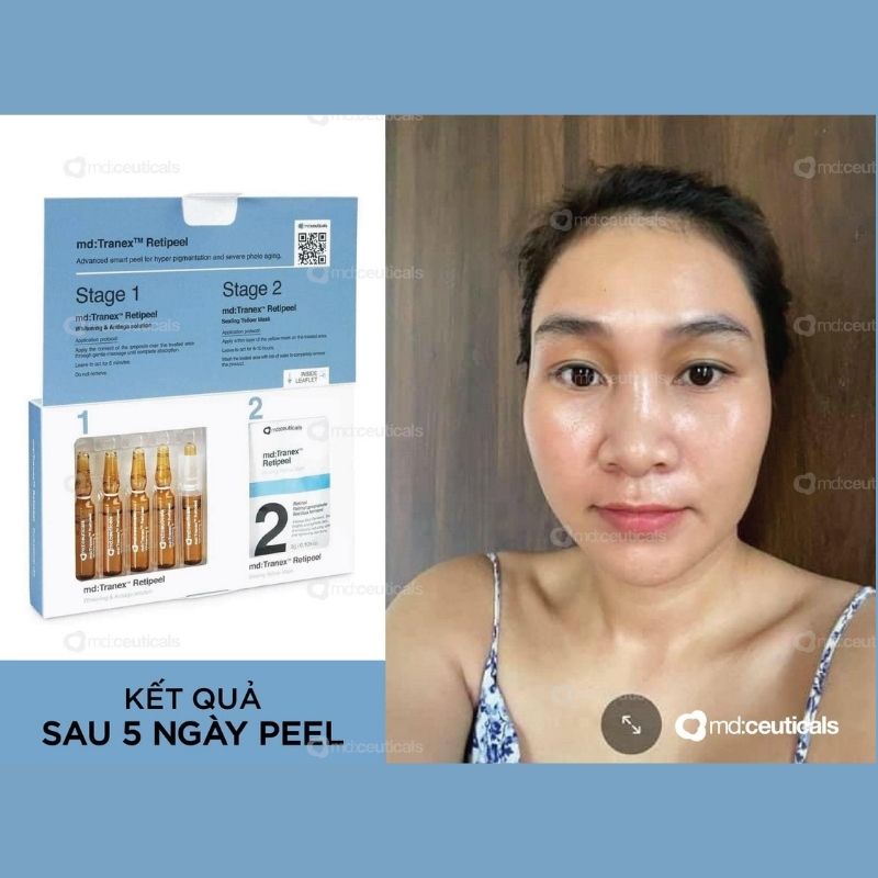 /storage/product/7/Mdceuticals-Md-Tranex-Retipeel-(1).jpg