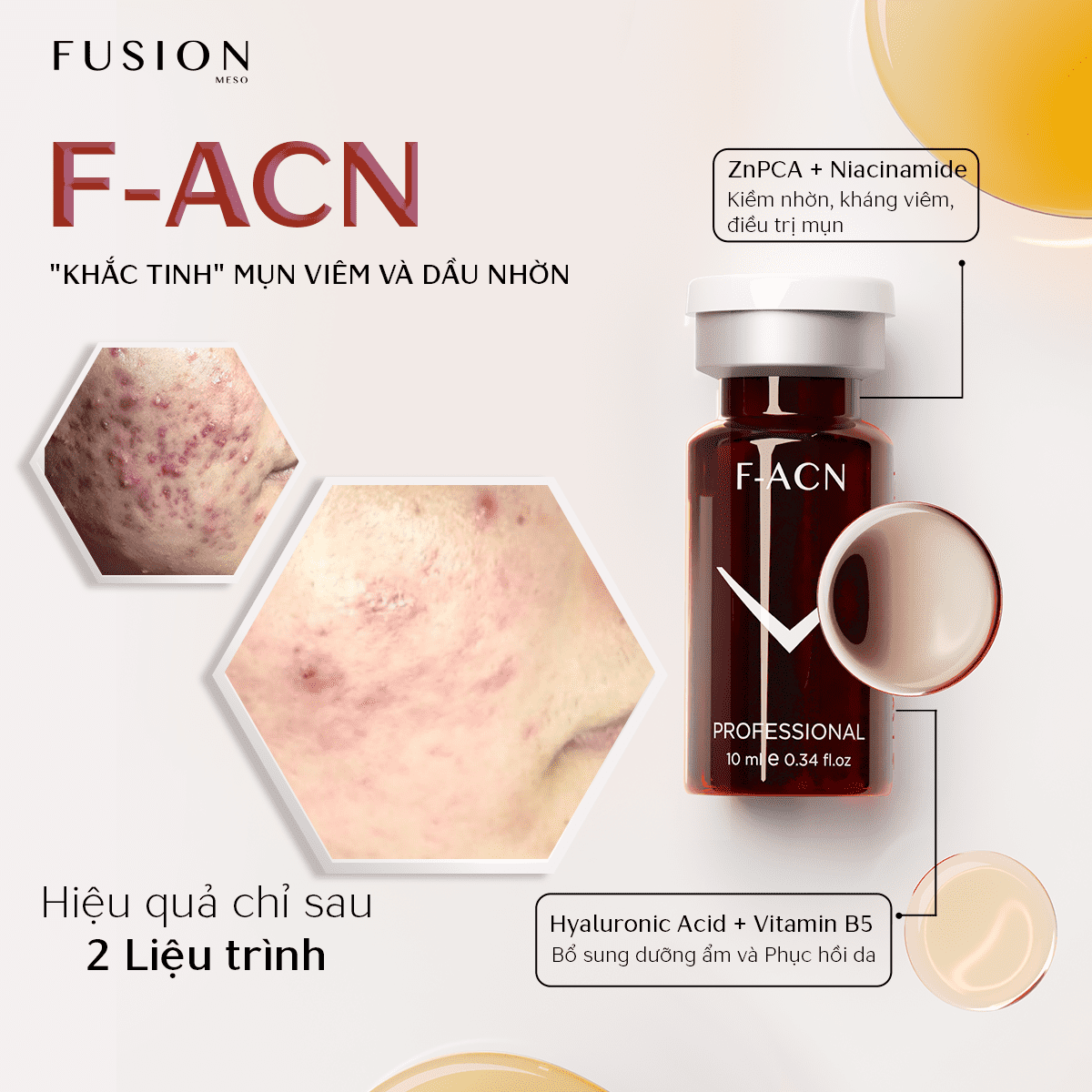 /storage/product/7/f-acn-dieu-tri-mun-trung-ca_1.png