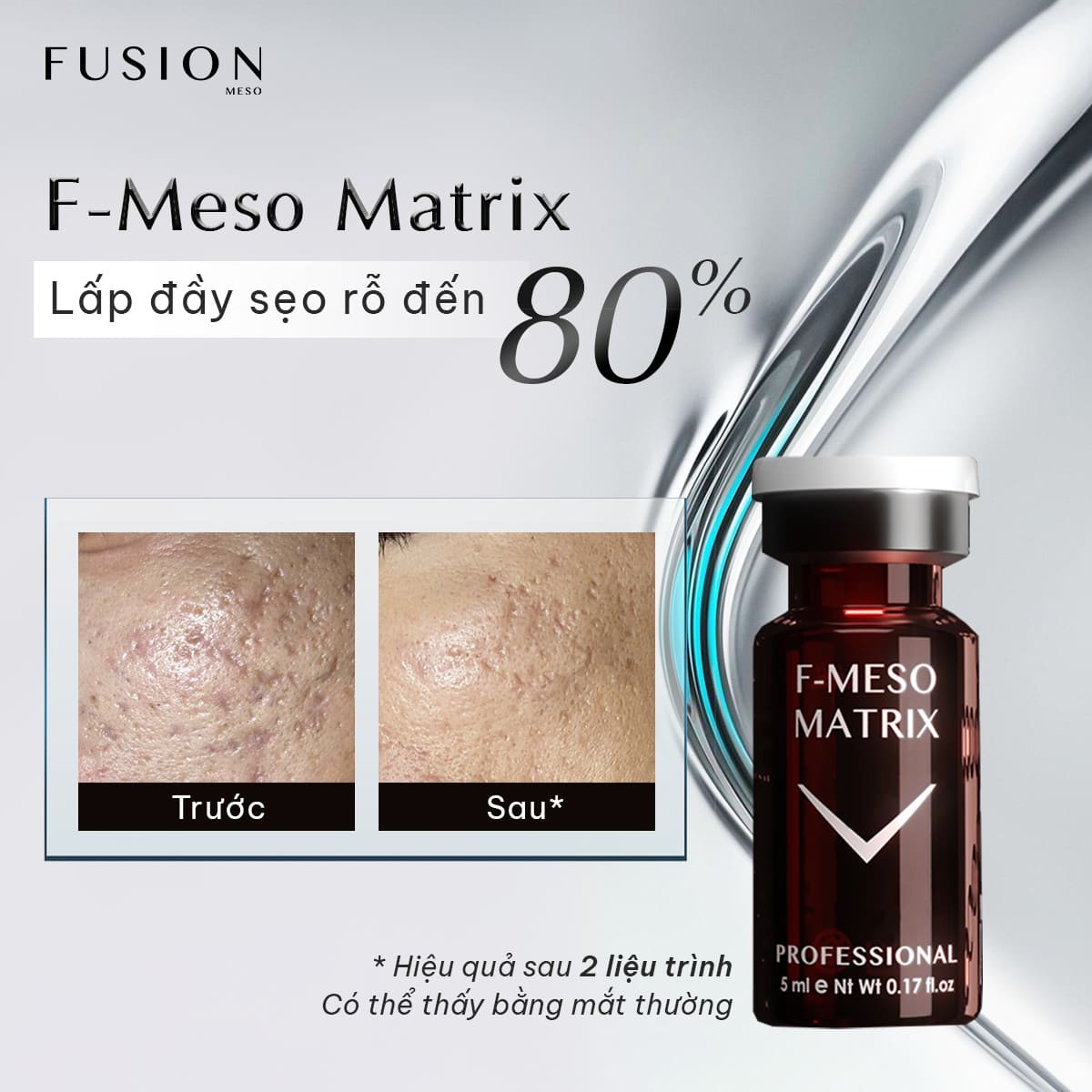/storage/product/7/f-meso-matrix-hieu-qua-dieu-tri-seo.jpeg