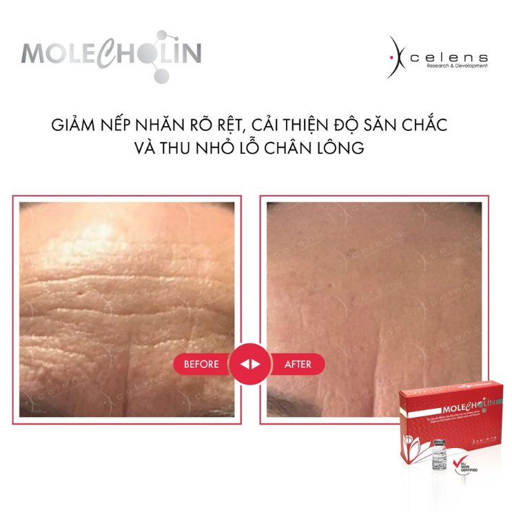 /storage/product/7/molecholin-3.png