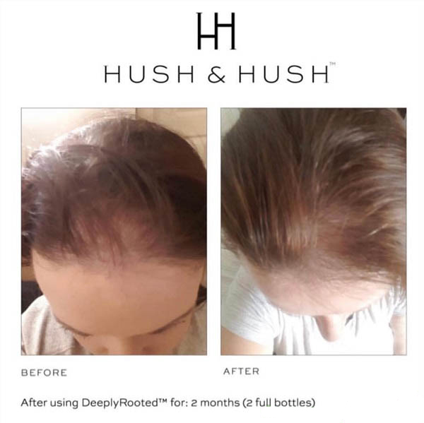 vien-uong-chong-rung-va-phuc-hoi-toc-Hush-Hush-Deeply-Rooted-6